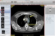 Escape Medical Viewer For Mac