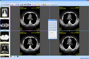 download the new version for ipod Sante DICOM Viewer Pro 12.2.8